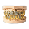 Teeth Grills